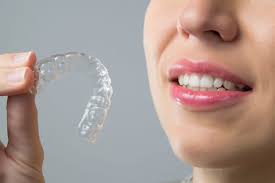 Luvoden™ Invisible Dental Aligners – Comfortable Teeth Straightening